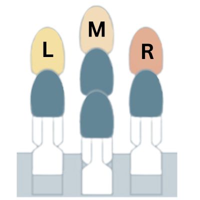 Why Should I Choose 1M1 Tooth Colour