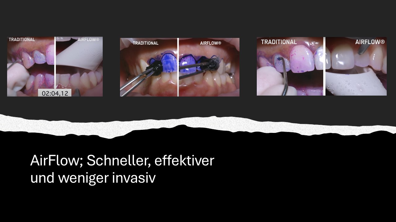 Der Ablauf der Airflow-Behandlung