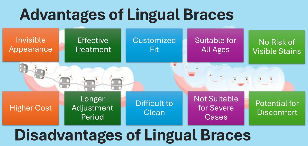 Lingual braces