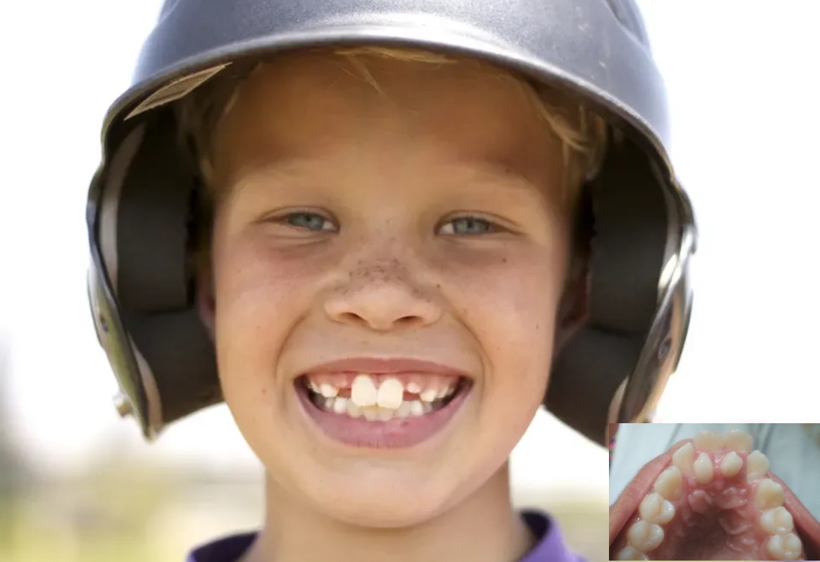 Freddie Mercury-style teeth 