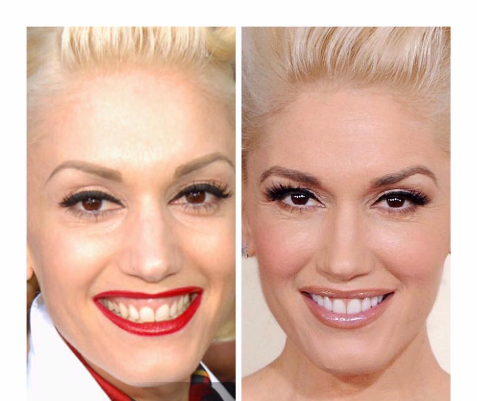 Gwen-Stefani-Before-After