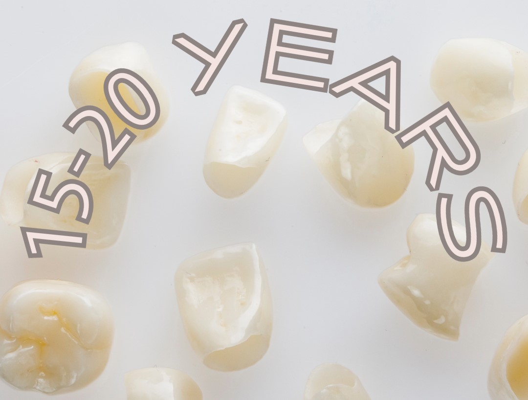 How Long Do Dental Crowns Last?