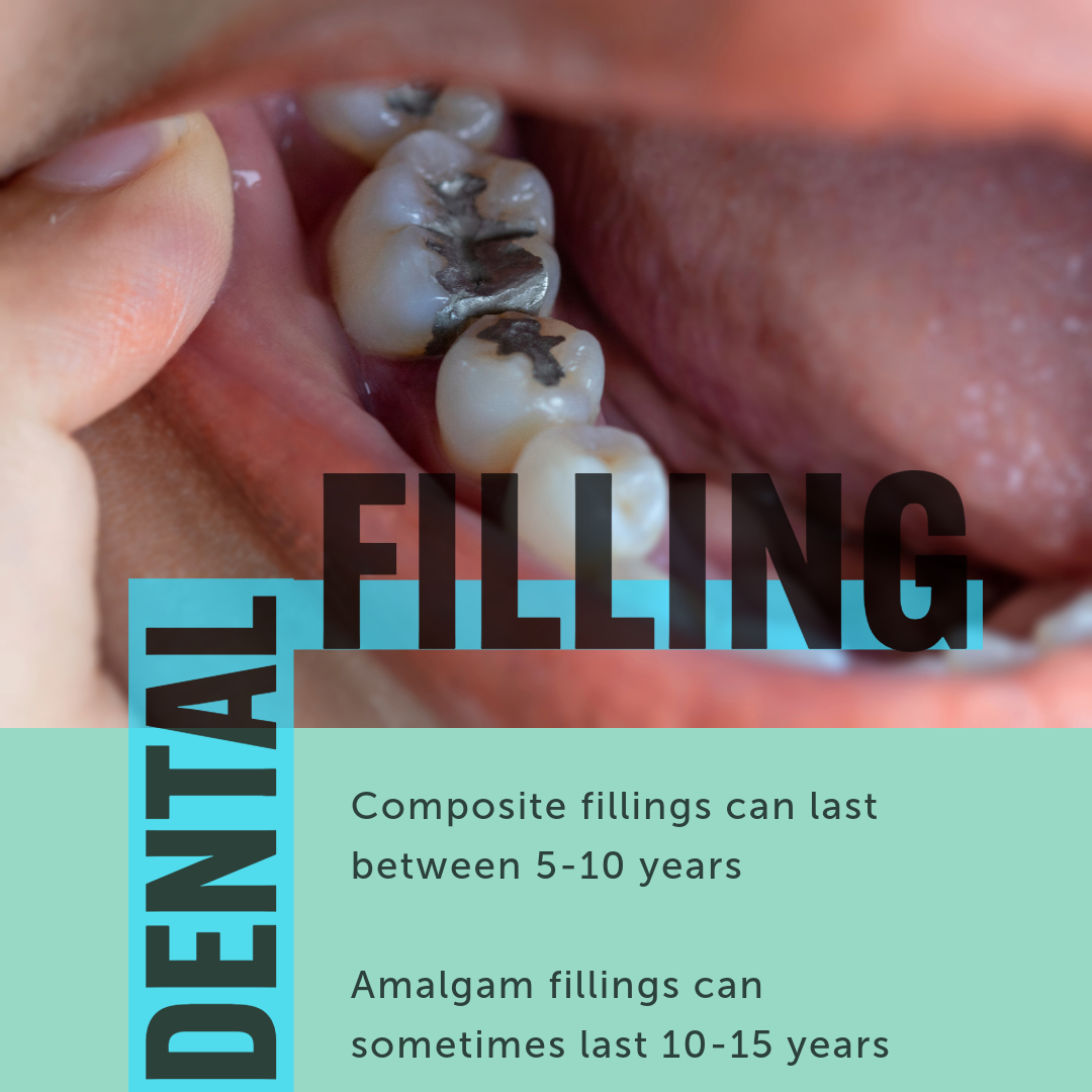 How Long Do Dental Filling Last?