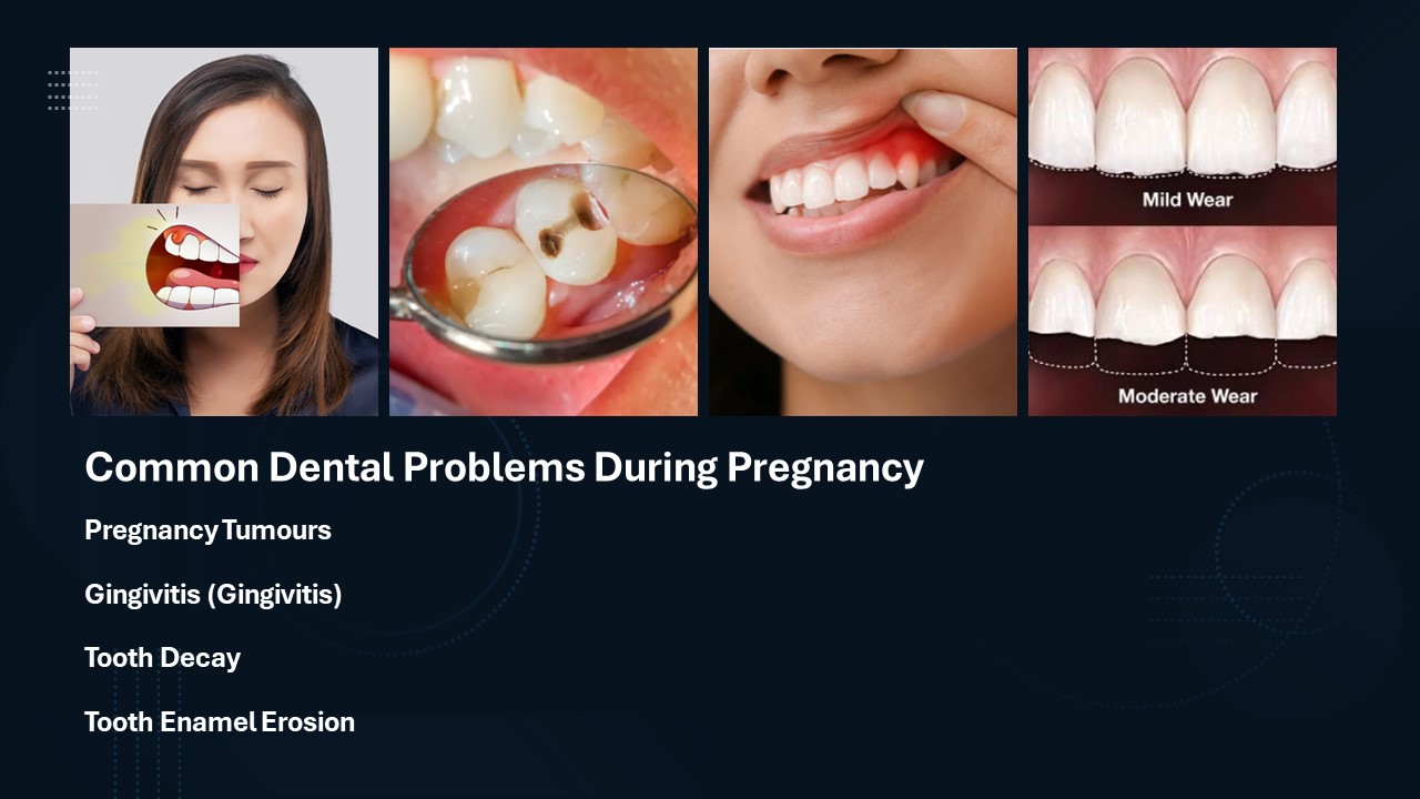 Common dental problems throughout pregnancy