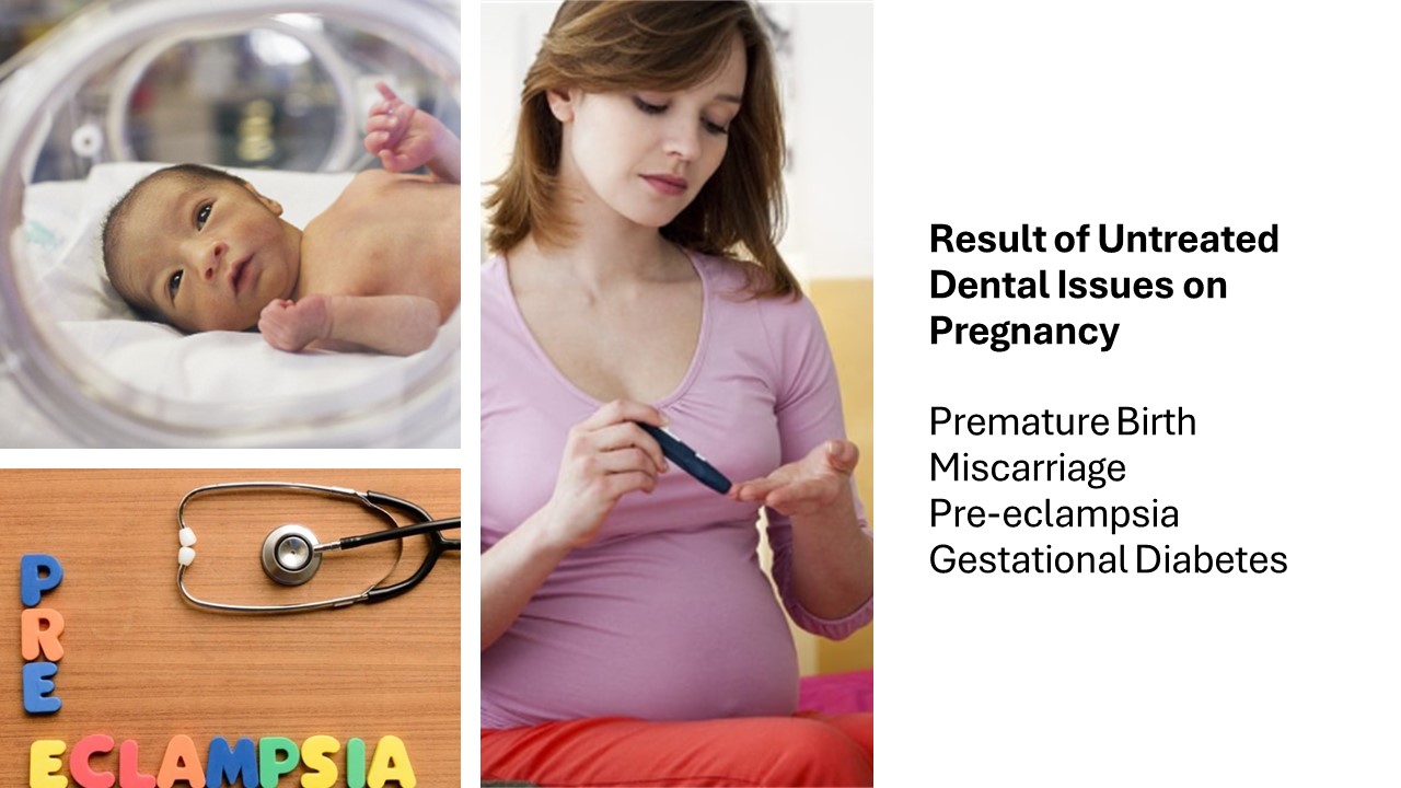 Result of untreated dental issues on pregnancy