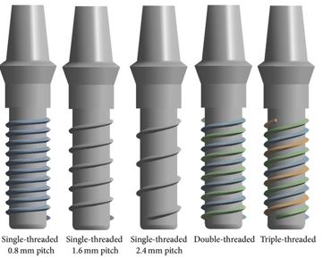 Screw-Type (Threaded) dental implants