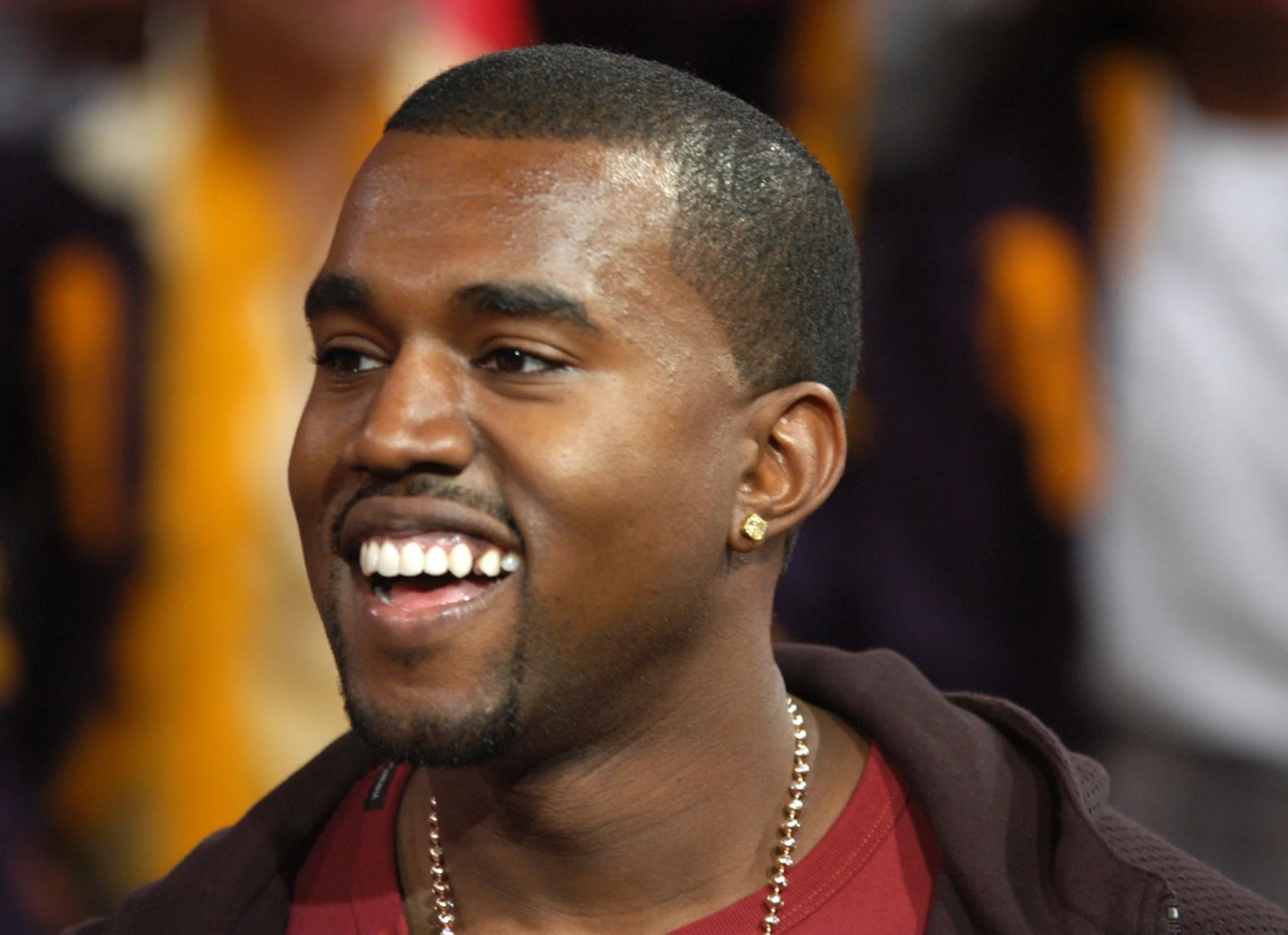 Kanye West teeth in the early years of his career