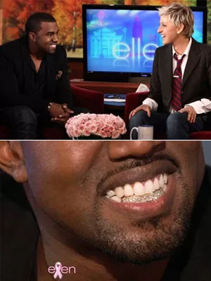 Kanye West Teeth in 2010