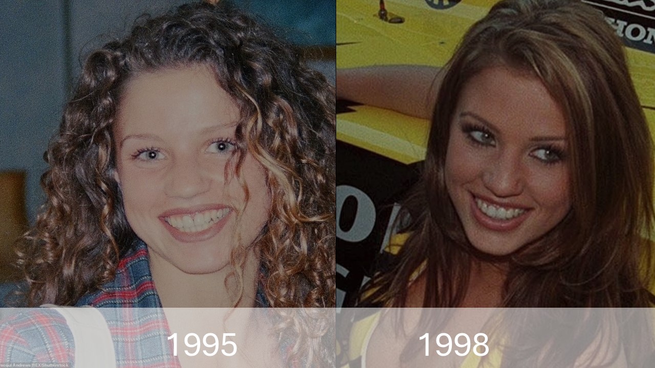 Katie Price Teeth Transformation in 1997