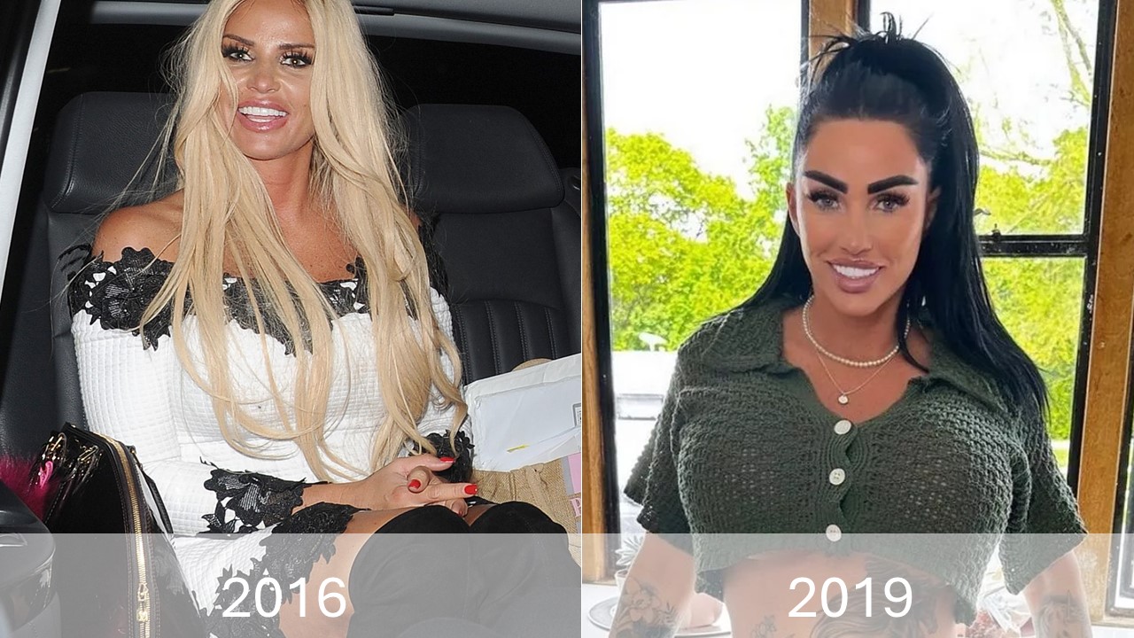 Was Katie Price's 2007 Dental Transformation Right?