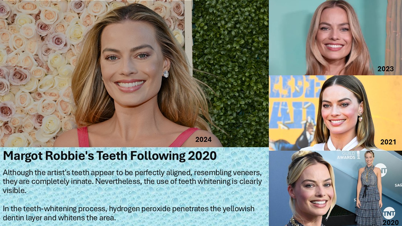 Margot Robbie Teeth in 2020