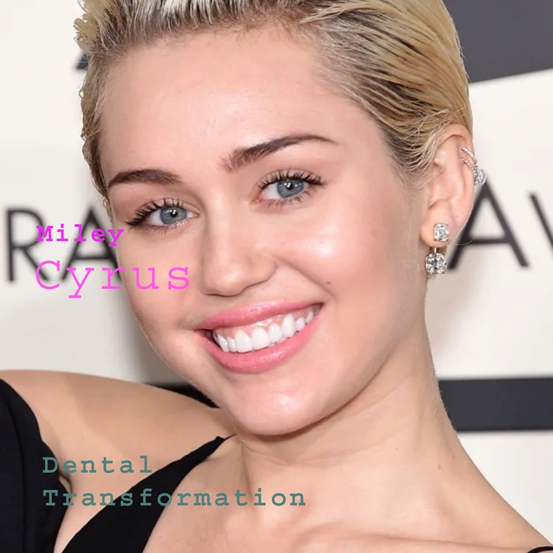 Miley Cyrus Teeth