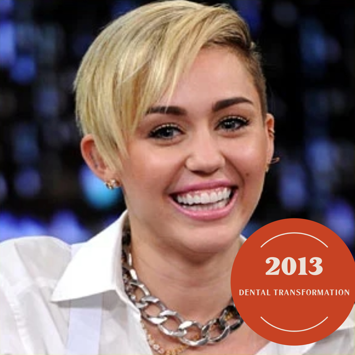 Miley Cyrus Teeth 2013