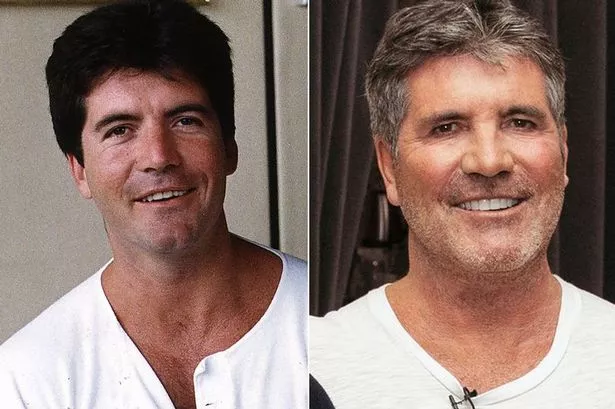 Simon-Cowell-Before-After