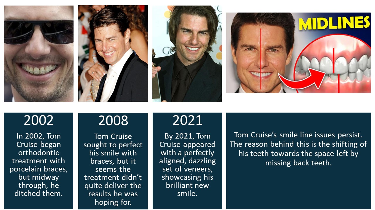 Tom Cruise's teeth during his adulthood