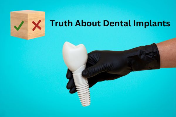 Правда о зубных имплантатах