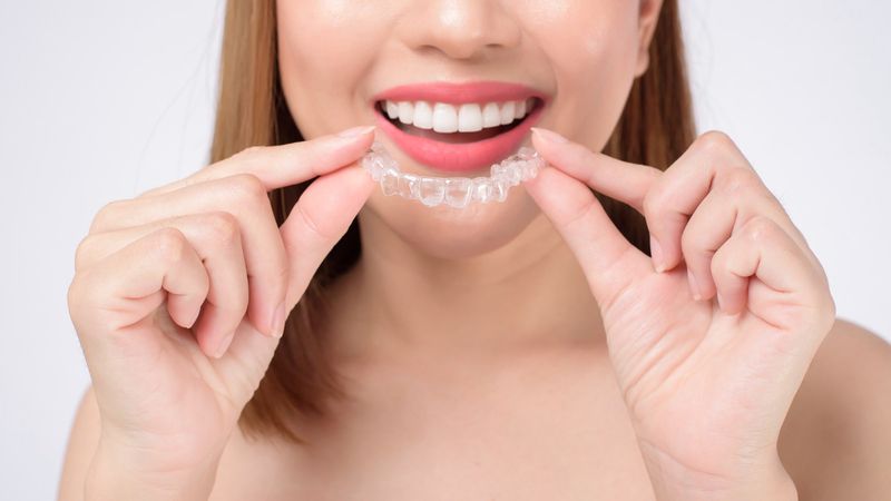 women holds Invisalign teeth and smiles