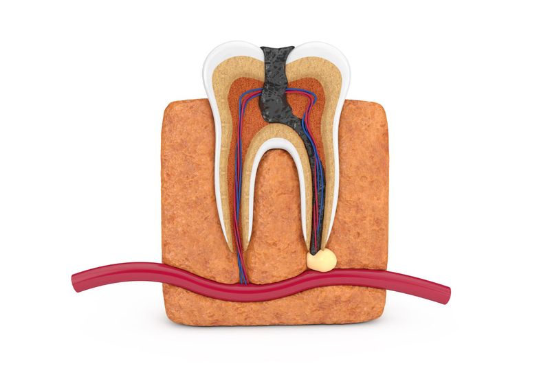 the situation of a teeth needs Root Canal Treatment is shown on a mini teeth model.