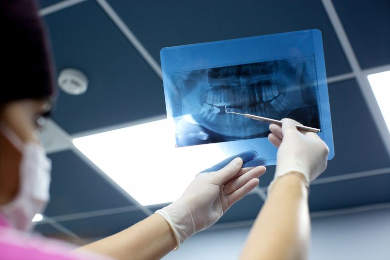 patient mouth is examined whether Root Canal Treatment is needed or not.