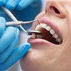 step-3-dental-treatment